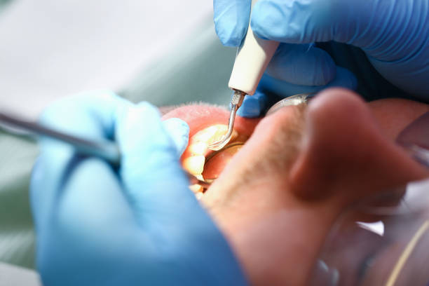 Best Pediatric Emergency Dentist in Belcourt, ND