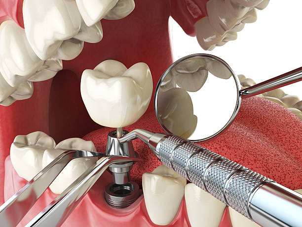 Best Urgent Care for Lost Fillings or Crowns in Belcourt, ND